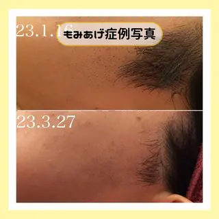 金山/脱毛/美肌 ULULUのエステ・リラクイメージ