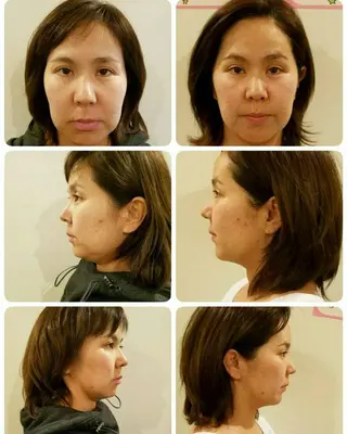 HappIness 遠赤外線ドームのエステ・リラクイメージ