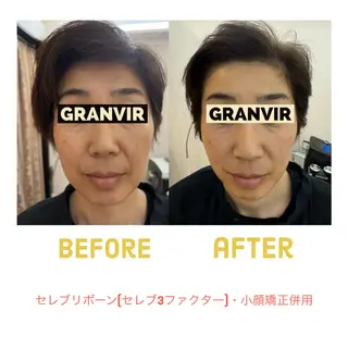 GRANVIR グランヴィールのエステ・リラクイメージ