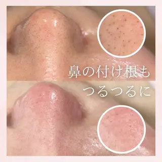 美肌脱毛&毛穴専門 Nico🐰ྀི♡のエステ・リラクイメージ