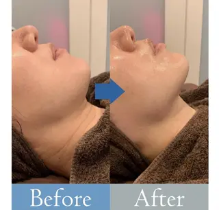 Crescent Beautyのエステ・リラクイメージ