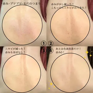 mison 安形友花のネイルデザイン