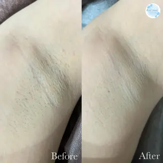 美容鍼脱毛salon リノン吹田駅前店のエステ・リラクイメージ