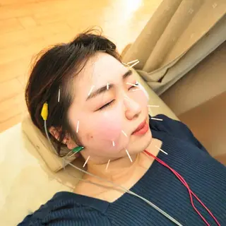 お顔のむくみたるみ 専門☆美容鍼小顔矯正のエステ・リラクイメージ