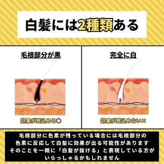 有人型セルフサロン 脱毛/痩身/美顔のエステ・リラクイメージ