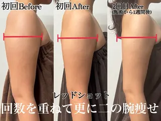 六本木脱毛andS 店長Sachiのエステ・リラクイメージ