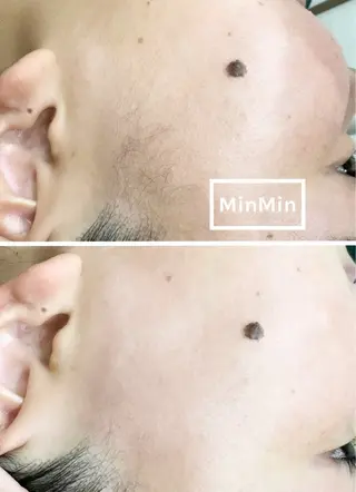 TReiS eyelashのマツエク・マツパデザイン