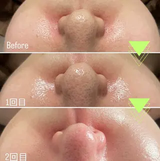 Lien eye salonのマツエク・マツパデザイン