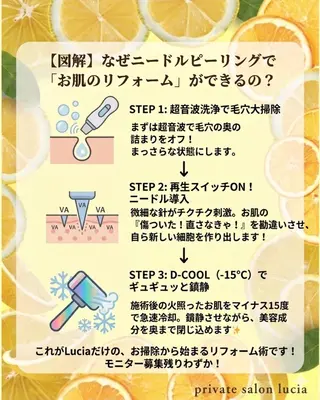 lucia  豊明 肌管理のエステ・リラクイメージ