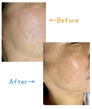 メナード高槻登町 にしはらひさえのエステ・リラクイメージ