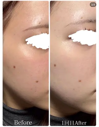 N_BLANC .ROPPONGIのエステ・リラクイメージ