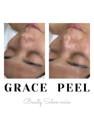 韓国肌管理 白玉肌管理®︎のエステ・リラクイメージ