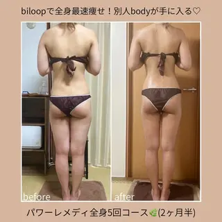 《本気痩せ×疲労改善 》  BILOOPのエステ・リラクイメージ