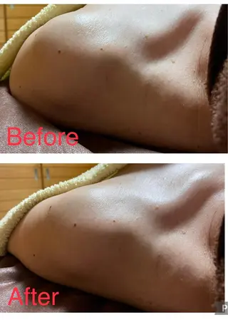 ハウオリベリー所属・うえば すみかのエステ・リラクイメージ