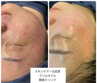 leolo武蔵浦和 肌質改善＆脱毛のエステ・リラクイメージ