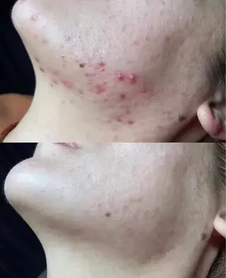 ネイル aliaハーブ水光店 エステティシャン募集のエステ・リラクイメージ