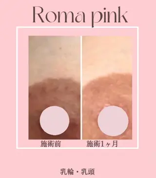 LiLL 熊本のエステ・リラクイメージ