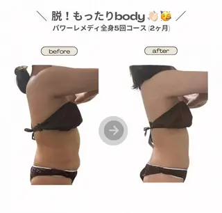 《本気痩せ×疲労改善 》  BILOOPのエステ・リラクイメージ