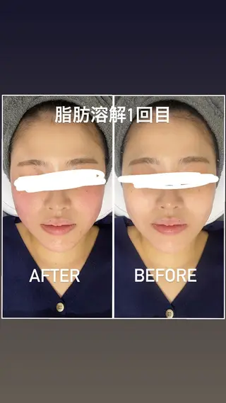 毛穴洗浄・痩身・脱毛 /アルカンジュのエステ・リラクイメージ