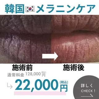 シミ・若返り特化 さゆみのエステ・リラクイメージ