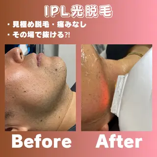 メンズ 肌質改善/都度脱毛 Mahinaのエステ・リラクイメージ