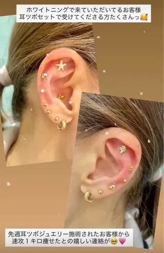 Kaula ホワイトニング🦷✨のエステ・リラクイメージ