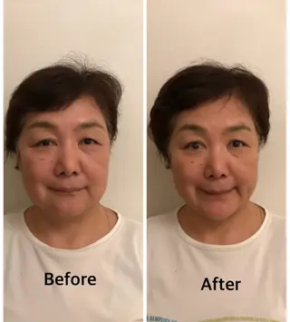 町田・鶴川 小顔矯正 /鈴木友実のエステ・リラクイメージ