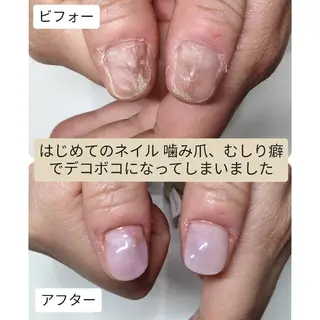 ネイル ネイルサロンアリューム所属・ネイルサロン アリュームのネイルデザイン