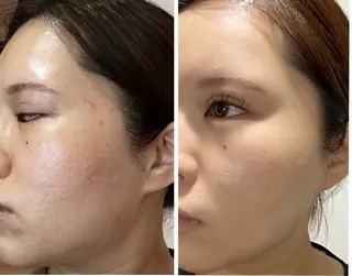 💎うる艶肌💎 スズキのエステ・リラクイメージ