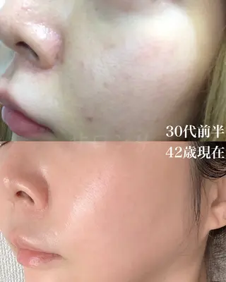 グリーンピール専門店 サロンY【大阪】のエステ・リラクイメージ