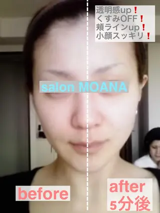 小顔美肌salon MOANAのエステ・リラクイメージ