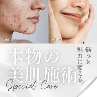 Adam 上半身美人のエステ・リラクイメージ