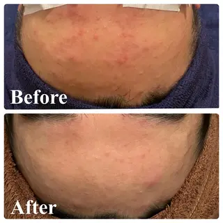 🌴Beauty Salon LANAのエステ・リラクイメージ