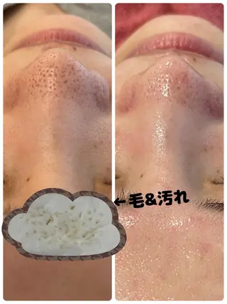 Dione八王子店所属・LUKE （ルーク）のエステ・リラクイメージ