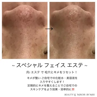 ビューティー ミロワールのエステ・リラクイメージ