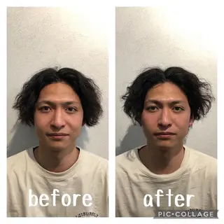 小顔矯/美容鍼/鍼灸 BeauJuのその他イメージ