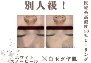 🐶レイビス 銀座店🐶simaのエステ・リラクイメージ