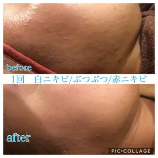 ロング カラー パーマ ヘアアレンジ キッズ ネイル マツエク・マツパ EnsorClair 代表　野口真央のエステ・リラクイメージ