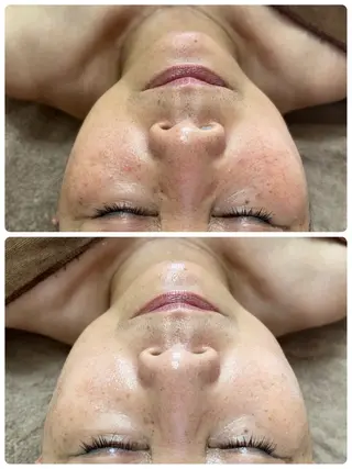 サロン・ド シエル所属・サロン・ド シエルのエステ・リラクイメージ