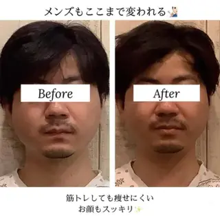 小顔矯正 natsuのエステ・リラクイメージ