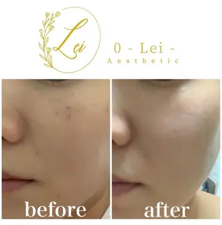 レイエステティック スタッフのエステ・リラクイメージ