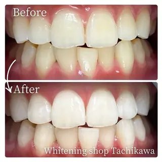 セルフ　ホワイト ニングショップ立川のその他イメージ