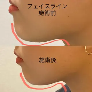 美容鍼 蕾【谷町六丁目】のエステ・リラクイメージ
