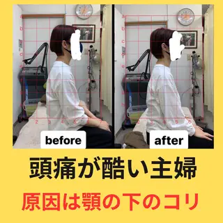 肩こり頭痛さようなら 整体カタギリのエステ・リラクイメージ