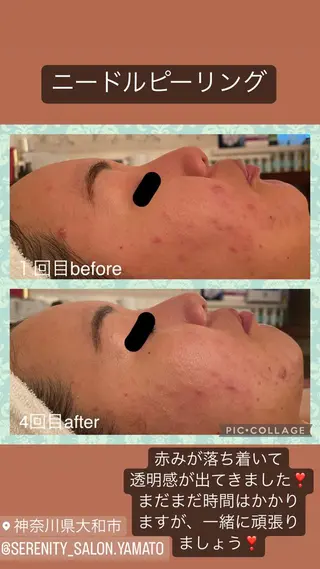 Serenity salonのエステ・リラクイメージ