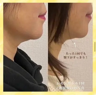 看護師が施術する小顔 サロン/KIKIのエステ・リラクイメージ