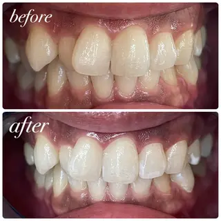 Libra所属・LIBRA心斎橋 セルフホワイトニングのその他イメージ