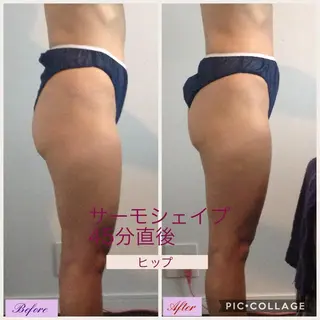 UnCouture 〜アンクチュール〜のエステ・リラクイメージ