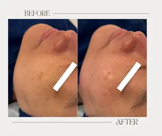 艶肌ワックス ALLY.のエステ・リラクイメージ