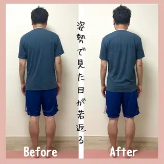 小顔モニター 募集のエステ・リラクイメージ